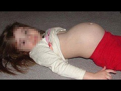 أغرب 8 حالات ولادة في العالم