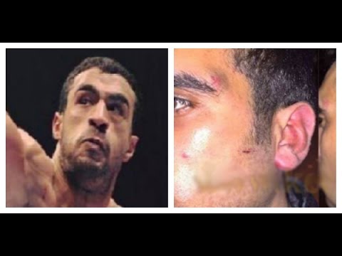 شاهد بدر هاري يعتدي على شاب في ملهى ليلي بسبب ”الفودكا”