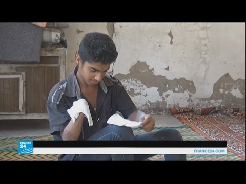 شاهد طفل يروي تفاصيل قطع تنظيم داعش ليده