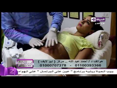 شاهد تكنولوجيا تجميد الدهون لتكسير وإذابتها في الجسم