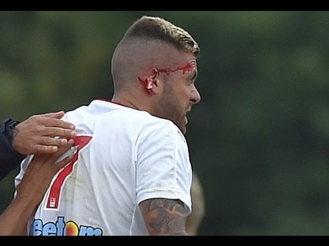 شاهد قطع أذن جيريمى مينيز فى أول مباراة له مع بوردو الفرنسى