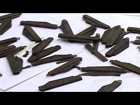 بالفيديو شاهد اخراج 40 موسًا من معدة رجل