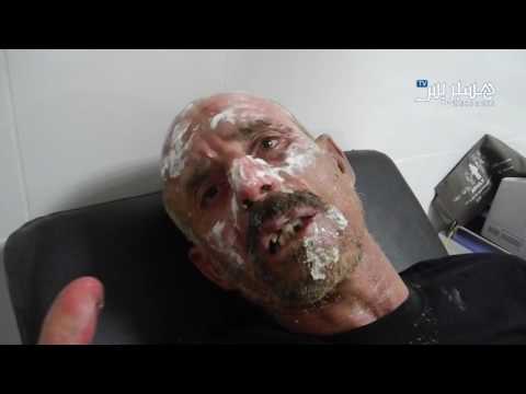 بالفيديو ضحية حريق في خريبكة