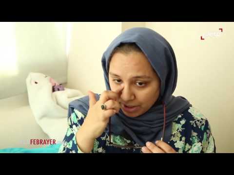 بالفيديو قصة الطفل الذي نهش وجهه البيتبول