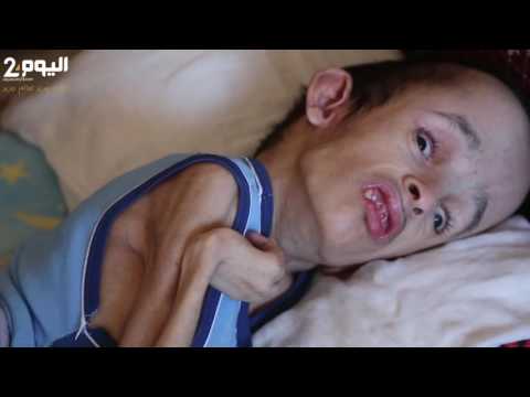 شاهد شاب في سن 24 مازال رضيعًا