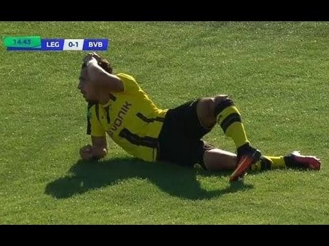 شاهد إصابة مروعة للاعب دورتموند الألماني للشباب
