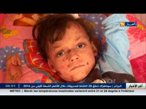 بالفيديو عائلة عميرات تناشد المحسنين و أصحاب القلوب الرحيمة للتكفل بابنتها