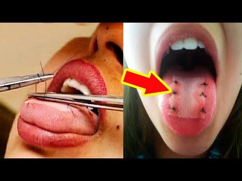 شاهد 10 وسائل  مجنونة وغريبة  لإنقاص الوزن