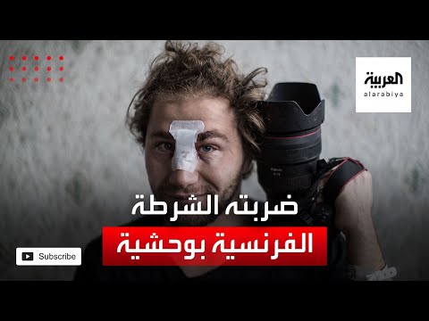 مصور سوري يروي ما تعرض له من عنف الشرطة في فرنسا
