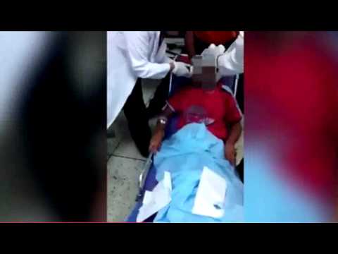 بالفيديو لقطات مروعة لطبيب ينزع سكينا من عين رجل