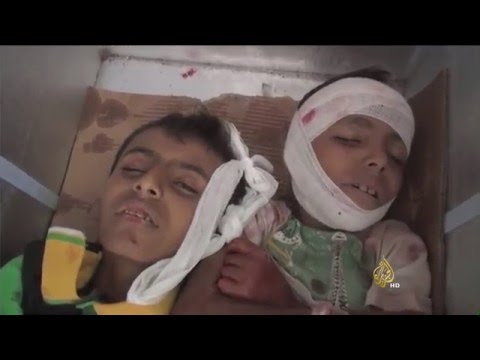 شاهد مطالبات بتدخل دولي لوقف مجازر الحوثيين