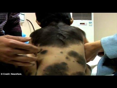 طفل يبلغ عام وينمو له فراء كالحيوانات