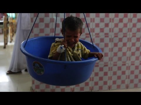 الهند تحاول التصدي لسوء التغذية في ظل ارتفاع عدد السكان