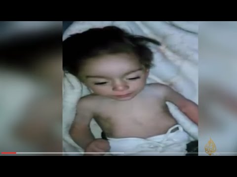 الماء والملح أصبحا الغذاء الأساسي في مضايا