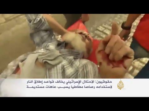 معاناة طفل فلسطيني أصابته قوات الاحتلال في رأسه