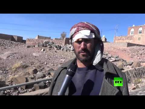 شاهد ضحايا جراء غارات جوية على كوكبان اليمنية